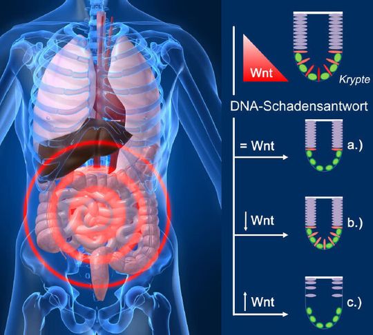 Das Überleben von Stammzellen im Darm wird bei DNA-Schäden von der Wnt-Aktivität geregelt - sie überleben nur am Rand der Krypte und bei geringer Wnt-Aktivität. Die Wnt-Aktivierung verstärkt das Absterben; die Hemmung fördert dagegen das Überleben geschädigter Stammzellen. Das Überleben von Stammzellen im Darm wird bei DNA-Schäden von der Wnt-Aktivität geregelt - sie überleben nur am Rand der Krypte und bei geringer Wnt-Aktivität. Die Wnt-Aktivierung verstärkt das Absterben; die Hemmung fördert dagegen das Überleben geschädigter Stammzellen.