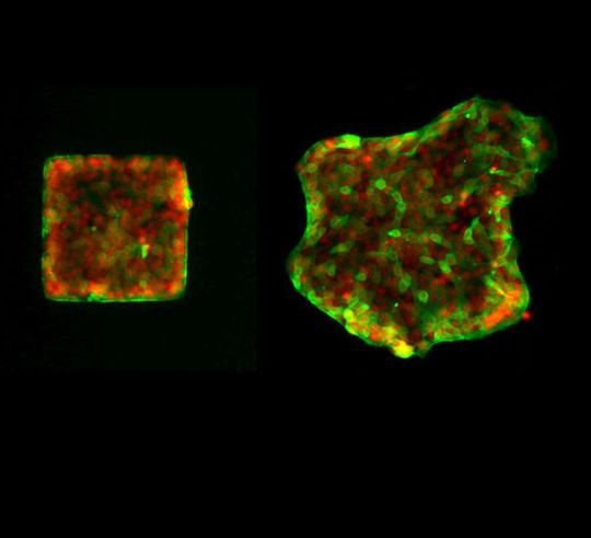 Leuchtende Spur der Zellbewegung: Mit fluoreszierenden Proteinen markieren Forscher des Max-Planck-Instituts für Intelligente Systeme die Kerne von Zellen (rot) und das Protein Merlin (grün). Anschließend beobachten sie, wie sich Merlin in den Zellen verteilt, wenn diese aus einem anfangs quadratisch umrissenen Bereich herauswandern. So haben sie die Rolle von Merlin bei der Zellbewegung aufgeklärt, die auch für die Wundheilung wichtig ist. Leuchtende Spur der Zellbewegung: Mit fluoreszierenden Proteinen markieren Forscher des Max-Planck-Instituts für Intelligente Systeme die Kerne von Zellen (rot) und das Protein Merlin (grün). Anschließend beobachten sie, wie sich Merlin in den Zellen verteilt, wenn diese aus einem anfangs quadratisch umrissenen Bereich herauswandern. So haben sie die Rolle von Merlin bei der Zellbewegung aufgeklärt, die auch für die Wundheilung wichtig ist.