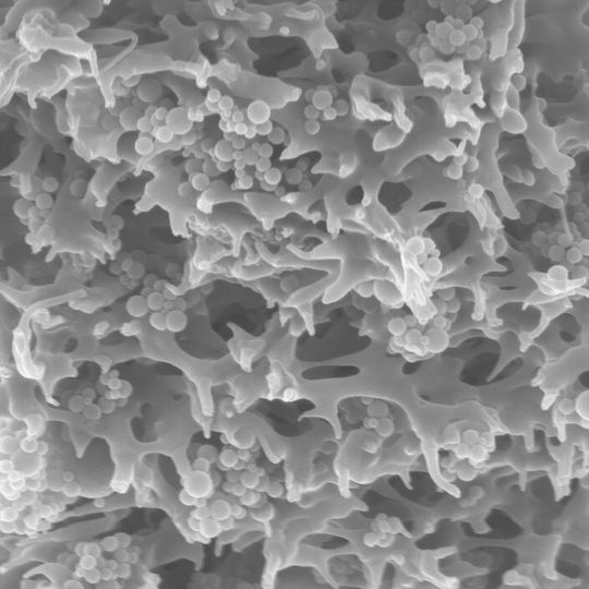 In der porösen Trägerstruktur der Membranadsorber sind winzige Polymerpartikel eingebettet, die Schadstoffe aus dem Wasser binden. In der porösen Trägerstruktur der Membranadsorber sind winzige Polymerpartikel eingebettet, die Schadstoffe aus dem Wasser binden.