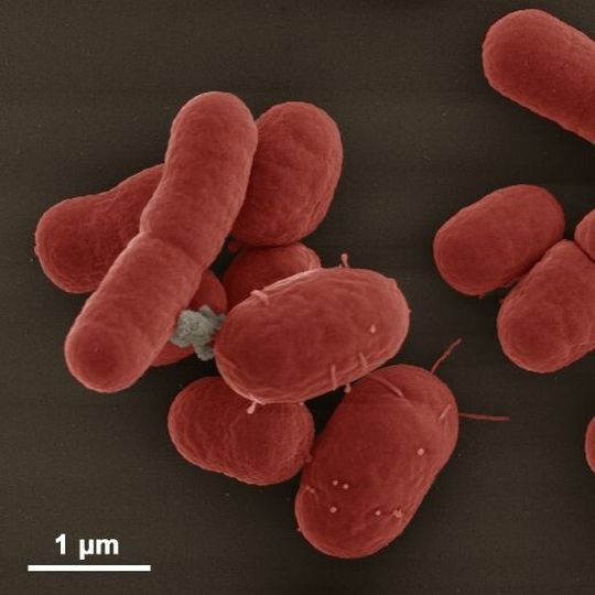 Das Bakterium Acinetobacter baumannii; Rasterelektronenmikroskopie Das Bakterium Acinetobacter baumannii; Rasterelektronenmikroskopie