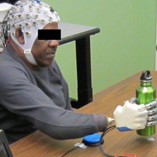 Gegenstände durch Gedankensteuerung greifen: Wissenschaftler der Universität Houston in Texas haben eine bionische Hand entwickelt, die sich durch Hirnimpulse steuern lässt.