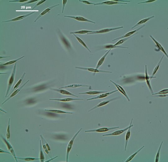 Abb. 1a: Zellen der Mikroalge Phaeodactylum tricornutum vor dem Aufschluss Abb. 1a: Zellen der Mikroalge Phaeodactylum tricornutum vor dem Aufschluss