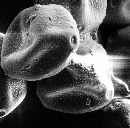 Elektronenmikroskopische Aufnahme von Haselpollen: Haselpollen lösen oft schon im Februar Allergien aus, da die Pflanze früh im Jahr blüht (Ausschnitt). Elektronenmikroskopische Aufnahme von Haselpollen: Haselpollen lösen oft schon im Februar Allergien aus, da die Pflanze früh im Jahr blüht (Ausschnitt).