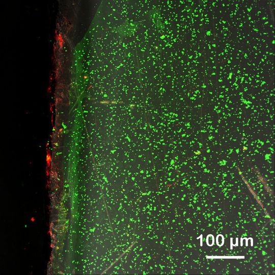 Biofilm auf einem Aufwuchsträger aus Acrylglas 24 h nach Einbringung in den Biogasreaktor (37°C). Rot: Gesamtheit aller Bacteria/Archaea, grün: Extrazelluläre, polymere Substanzen bilden die schleimige Matrix des Biofilms. Biofilm auf einem Aufwuchsträger aus Acrylglas 24 h nach Einbringung in den Biogasreaktor (37°C). Rot: Gesamtheit aller Bacteria/Archaea, grün: Extrazelluläre, polymere Substanzen bilden die schleimige Matrix des Biofilms.