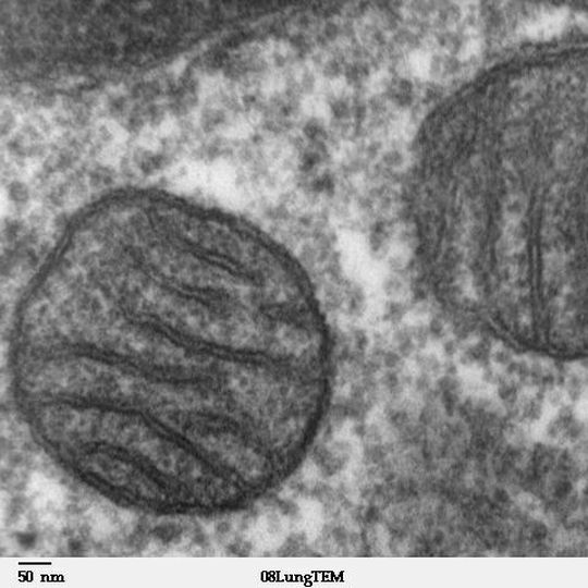 Elektronenmikroskopische Aufnahme von Mitochondrien. Elektronenmikroskopische Aufnahme von Mitochondrien.