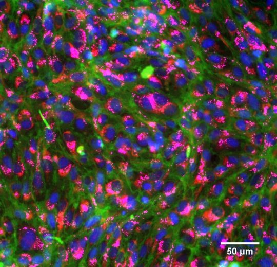 Angefärbte, gesunde Kiemenzellen von Regenbogenforellen: Zellkerne (blau), Membranen (grün), Mitochondrien (rot), Lysosome (pink). Angefärbte, gesunde Kiemenzellen von Regenbogenforellen: Zellkerne (blau), Membranen (grün), Mitochondrien (rot), Lysosome (pink).