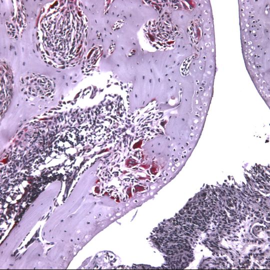 Möglicher Ansatzpunkt für Therapie von rheumatoider Arthritis – Wirkung von Myostatin auf die Knochen abbauenden Osteoklasten (hier rötlich-braun dargestellt). Möglicher Ansatzpunkt für Therapie von rheumatoider Arthritis – Wirkung von Myostatin auf die Knochen abbauenden Osteoklasten (hier rötlich-braun dargestellt).