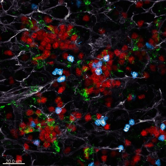Im Lymphknoten: Rot dargestellt sind die Killerzellen, blau die Helferzellen. Grün eingefärbt sind die dendritischen Zellen, auf denen sich die Killer- und Helferzellen treffen. Im Lymphknoten: Rot dargestellt sind die Killerzellen, blau die Helferzellen. Grün eingefärbt sind die dendritischen Zellen, auf denen sich die Killer- und Helferzellen treffen.