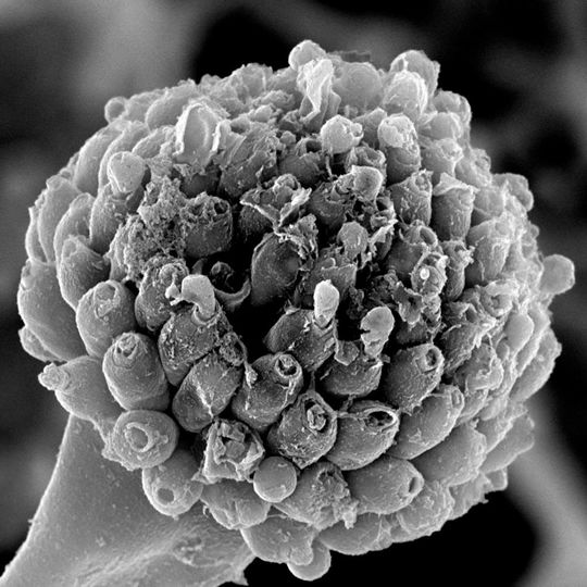 Die elektronenmikroskopische Aufnahme des Gießkannenschimmels (Aspergillus) zeigt deutlich, dass nach Behandlung mit dem körpereigenen Fungizid der Sporenträger des Pilzes zerstört ist. Die elektronenmikroskopische Aufnahme des Gießkannenschimmels (Aspergillus) zeigt deutlich, dass nach Behandlung mit dem körpereigenen Fungizid der Sporenträger des Pilzes zerstört ist.
