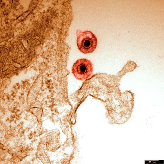 Pferdeherpesvirus (EHV) Pferdeherpesvirus (EHV)