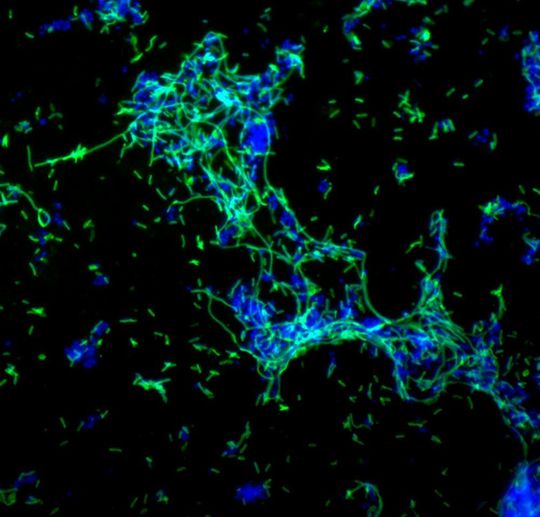 Epifluoreszenzmikroskopische Aufnahme von einem Biofilm von Legionella pneumophila (grün, Immunfluoreszenzfärbung) mit anderen Wasserbakterien (blau). Epifluoreszenzmikroskopische Aufnahme von einem Biofilm von Legionella pneumophila (grün, Immunfluoreszenzfärbung) mit anderen Wasserbakterien (blau).