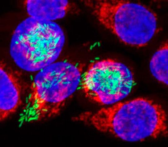 Mit einer an der Universität Würzburg entwickelten neuen Methode können Forscher weit detaillierter als bisher nachvollziehen, was bei Infektionen in Krankheitserregern und den von ihnen befallenen Zellen vor sich geht. Das Foto zeigt menschliche Zellen (rot/blau), die mit Salmonellen (grün) infiziert wurden. Die Bakterien wurden mit einem fluoreszierenden Farbstoff markiert; das erklärt ihre grüne Farbe. Mit einer an der Universität Würzburg entwickelten neuen Methode können Forscher weit detaillierter als bisher nachvollziehen, was bei Infektionen in Krankheitserregern und den von ihnen befallenen Zellen vor sich geht. Das Foto zeigt menschliche Zellen (rot/blau), die mit Salmonellen (grün) infiziert wurden. Die Bakterien wurden mit einem fluoreszierenden Farbstoff markiert; das erklärt ihre grüne Farbe.
