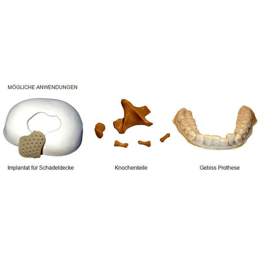 Durch die Zertifizierung für den medizinischen 3D-Druck sollen PEEK-Implantate künftig schneller und günstiger hergestellt werden Durch die Zertifizierung für den medizinischen 3D-Druck sollen PEEK-Implantate künftig schneller und günstiger hergestellt werden