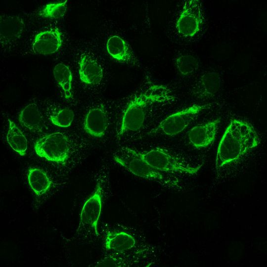 Mit dem Zika-Virus infizierte Zellen fluoreszieren, wenn sich im Blut des Patienten Antikörper gegen das Virus befinden. Mit dem Zika-Virus infizierte Zellen fluoreszieren, wenn sich im Blut des Patienten Antikörper gegen das Virus befinden.