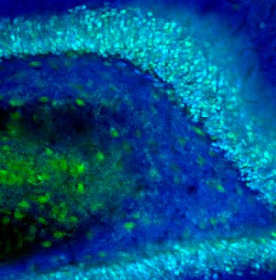 Körnerzellen im Gyrus dentatus einer Ratte, durch Fluoreszenzmikroskopie sichtbar gemacht (in Cyanblau). Körnerzellen im Gyrus dentatus einer Ratte, durch Fluoreszenzmikroskopie sichtbar gemacht (in Cyanblau).