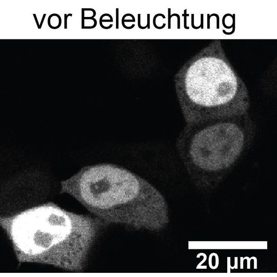 Mikroskopieaufnahmen von menschlichen, embryonalen Nierenzellen in Kultur (Ausschnitt) ... Mikroskopieaufnahmen von menschlichen, embryonalen Nierenzellen in Kultur (Ausschnitt) ...