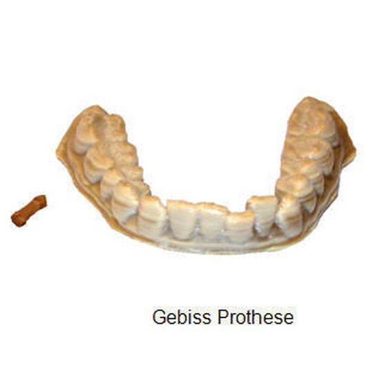 “PEEKmed“ Filament der Klasse IIa ist einsetzbar für verschiedene medizinische, dentale und chirurgische Anwendungen. “PEEKmed“ Filament der Klasse IIa ist einsetzbar für verschiedene medizinische, dentale und chirurgische Anwendungen.