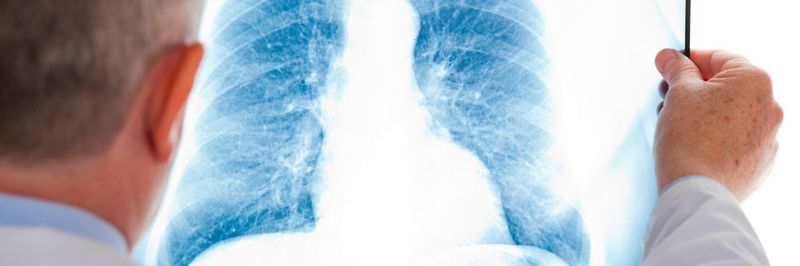 Zu ihren eigenen Röntgenbildern sollten auch Patienten Zugang haben