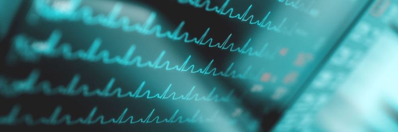 Für mehr Sicherheit im Netzwerk müssen die verschiedenen Geräte ihren Status kommunizieren, Sophos spricht auch von synchronisierter Sicherheit und dem Security Heartbeat.