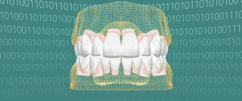 Bei Heraeus Kulzer geht niemand auf dem Zahnfleisch und kein Zahn bröckelt; denn das Dentalunternehmen digitalisierte und optimierte: Alle Zähne passen.