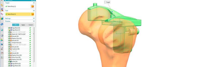 Die Convergent-Modeling-Technologie ermöglicht es, gescannte 3D-Daten als Facetten zu importieren und damit in Verbindung mit flächen und Solids direkt zu arbeiten.