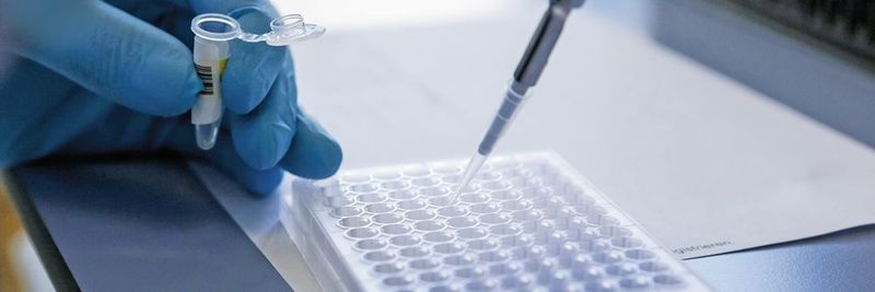 Abb. 1: Die Biocrates-Kits ermöglichen sowohl die automatisierte, als auch die händische Durchführung der Probenvorbereitung im 96-well-plate-Format.