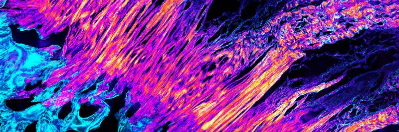 Fluoreszenz-Mikroskopbild des Übergangs von Sehne (links unten) zu Knochen (rechts oben). In der Mitte sind die feinen Fasern des Collagen-Typs 2 zu sehen.
