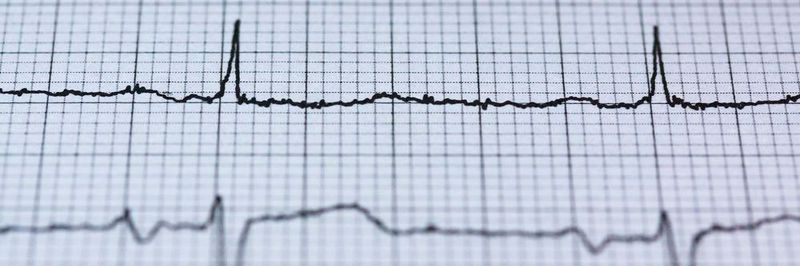 Ein Finanzierungsvolumen von 15 Mio. Euro erhält Cardior Pharmaceuticals. Das junge Biotechnologie-Unternehmen arbeitet an RNA-basierten Therapeutika für Patienten mit Herzerkrankungen.