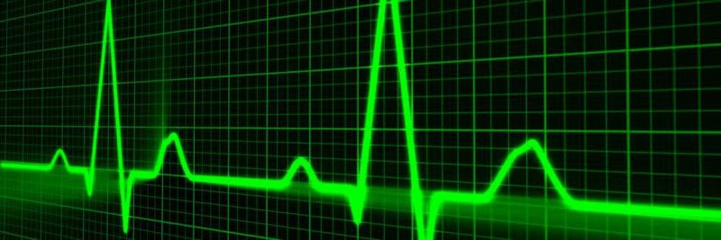 Am Puls der Software: Tracing auf der Betriebssystemebene erlaubt bessere Einblicke in die Echtzeit-Datenverarbeitung. Die Visualisierung ist dabei entscheidend für das Begreifen.