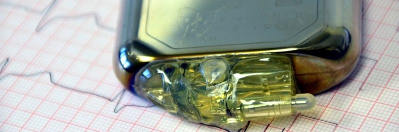Sicherheitslücke in Herzschrittmachern gefährdet Patienten