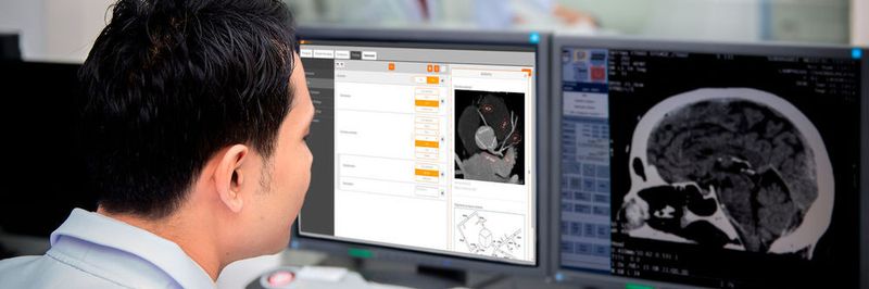 Ein Radiologe bei der Arbeit mit Smart Radiology