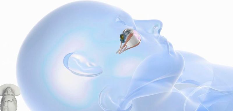 Das Augenimplantat des IRIS-II-Systems. Der Chip des IMMS übersetzt die optischen Informationen in einen elektronischen Datenstrom. Dieser wird an einen Retina-Stimulator weitergegeben, der den Sehnerv anregt.