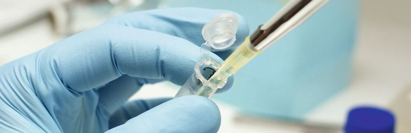 Abb. 1: Exaktes Pipettieren ist entscheidend für richtige und reproduzierbare Analysenergebnisse.