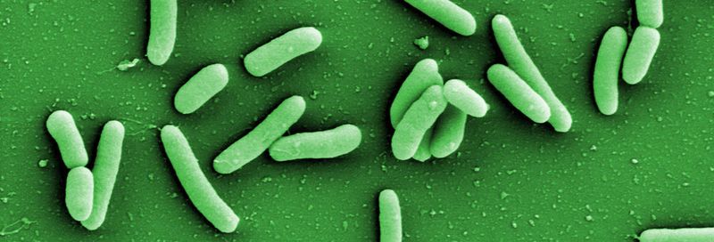 Bakterien der Art Pseudomonas aeruginosa sind äußerst widerstandsfähig und kommen fast überall vor.