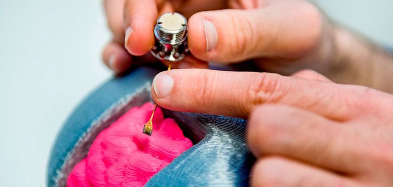 Elektroden im Gehirn leiten Impulse von Nervenzellen ab, die dann einen Roboterarm steuern. Der Anschluss der Elektroden liegt außerhalb des Schädels.