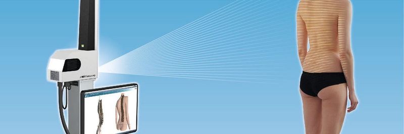 Bei den Vermessungsgeräten Formetric von Diers wirft ein über die Alpha Colonne elektrisch in der Höhe verstellbarer Lichtprojektor ein Linienraster auf den Rücken des Patienten.