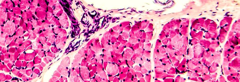Schilddrüsenhormone beeinflussen die Heilung von Skelettmuskeln. Im Bild: Vertikalschnitt eines Skelettmuskels unter dem Mikroskop.