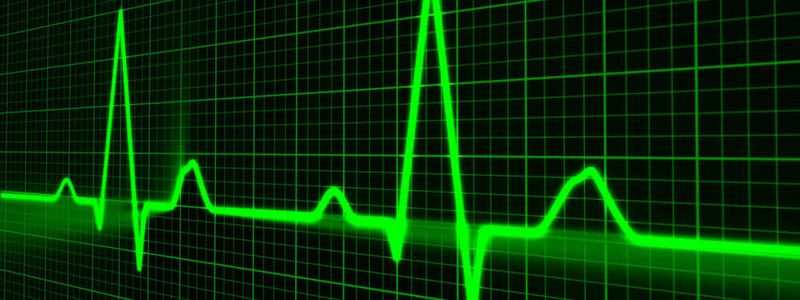 Wer den Zoo aus On-Premise-Anwendungen, hybriden Konzepten und Cloud-First-Modellen im Griff haben will, benötigt ein Monitoring, das die Fehlerbehebung erlaubt, bevor die Nulllinie erreicht ist.