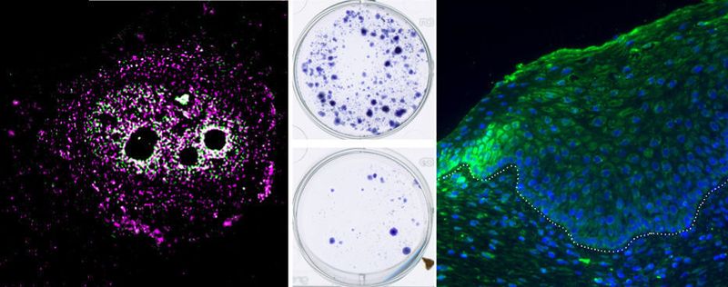 (v.l.n.r.): MYPOP-Lokalisation (magenta) in einer Hautzelle; Wachstum von HPV-Krebszellen ohne (oben) und mit MYPOP (unten); Gewebeschnitt eines HPV-Tumors (grün = MYPOP, blau = Zellkerne)
