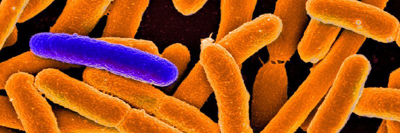 Manche Bakterien überdauern Antibiotikabehandlungen in einer Art Winterschlaf. (Beispielbild: Elektronenmikroskopie-Aufnahme von Escherichia coli; eingefärbt)