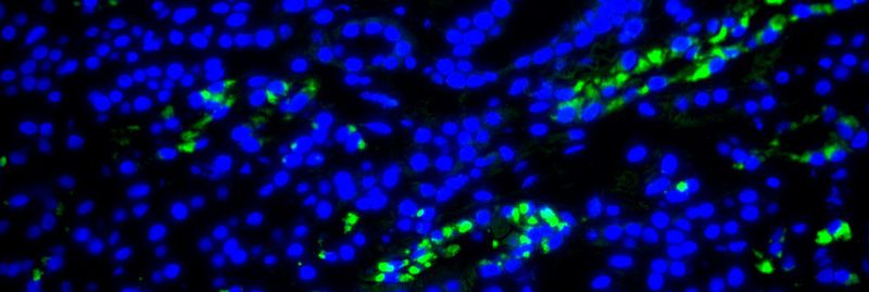 95 bis 100 Prozent der gesunden Erwachsenen sind mit einer Variante des menschlichen Herpesvirus 6 (HHV-6) infiziert. Normalerweise inaktiv und harmlos können diese Herpesviren z.B. durch Gabe spezieller Medikamente rekativiert werden. Im Bild: Fluoreszenzaufnahme aus der Nierenbiopsie der DRESS-Patientin mit HHV-6-kodierter sncRNA-U14 (grün). Die DNA wurde blau gefärbt.