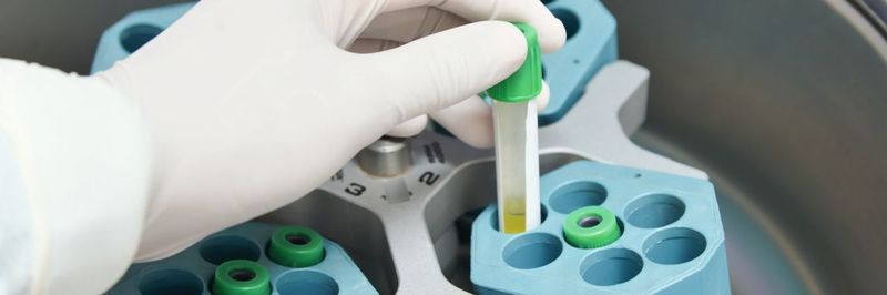 Tischzentrifugen müssen bei hohen Drehzahlen leise arbeiten und wenig Energie verbrauchen – dafür ist geeignete Antriebstechnik gefragt.