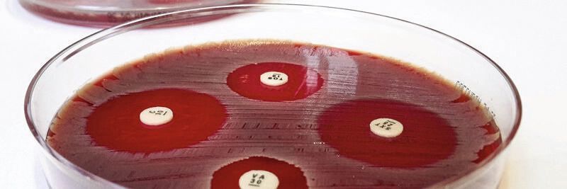 Der Agardiffusionstest macht Antibiotika-Resistenzen sichtbar.