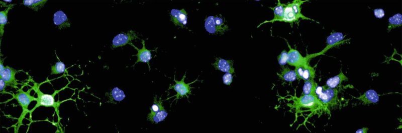 Myelin-Reparaturzellen (Oligodendrozyten) einer Maus in der Kulturschale. Sie stellen Myelin her (grün), das sie für die Reparatur der Nervenzell-Ummantelung verwenden. Zellkerne sind blau angefärbt.
