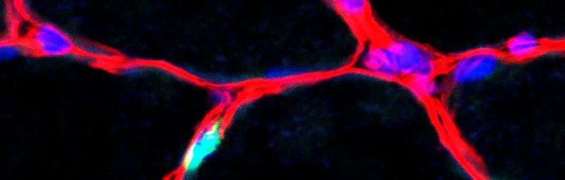 Skelettmuskulatur: Die Kerne der Muskelstammzellen sind in grün zu sehen. Die Zellkerne der Muskelfasern sind in blau, die Umgrenzung um die Muskelfasern (Basallamina) ist rot. Maßstab: 20µm.