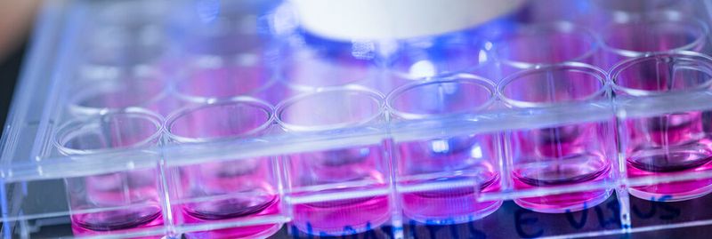 Humane Hepatoma-Zellen, die mit Hepatitis-E-Viren infiziert wurden, werden in der Immunfluoreszenz analysiert.