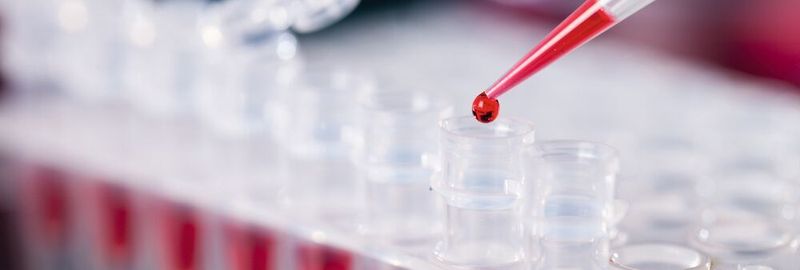 Abb. 1: Ob PCR, Verdünnungsreihe oder ELISA – Pipettieren gehört zu den wesentlichen Routine-Aufgaben im Labor. Präzision ist hier oberstes Gebot.