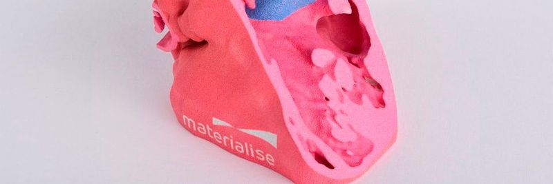 Materialise zertifiziert HP für den Druck anatomischer Modelle zu Diagnose- und chirurgischen Planungszwecken.