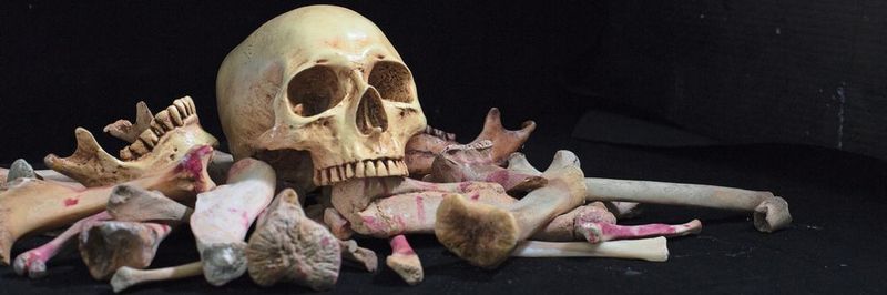 In Stuttgart arbeiten Forscher an 3D-druckbarer Knochentinte, die im Körper selbst Knochengewebe bildet und damit zerstörtes Originalgewebe ersetzen soll.