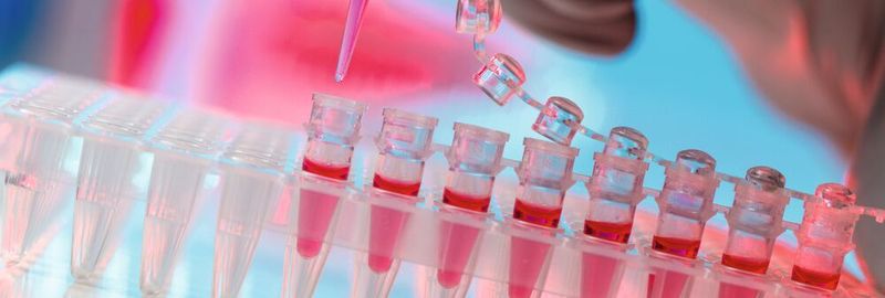 Fig. 1: In many laboratories, multiple sacks of consumables such as cell culture flasks, pipette tips, laboratory gloves and packaging are accumulated every day. Do we really need all of this?
